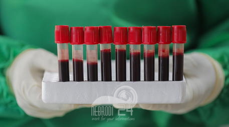 Ucria – Test sierologici anticovid per i dipendenti comunali